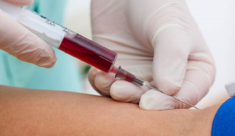 Mulher que contraiu HPV após traições do marido será indenizada – Jornal Advogado – Em Mato Grosso