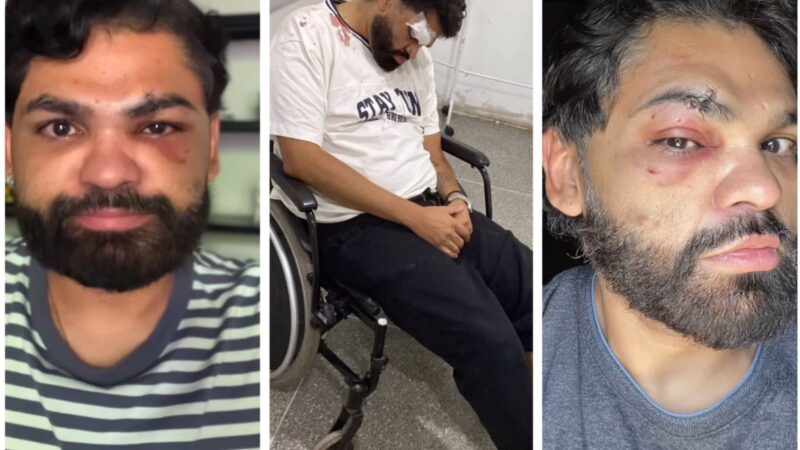 Psicólogo é agredido dentro de boate em Cuiabá e denuncia crime de homofobia