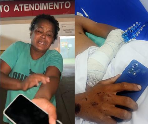 Adolescente internado relata larvas em ferimento após acidente
